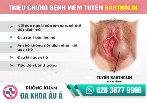Vùng kín bị sưng 1 bên mép là bệnh gì?